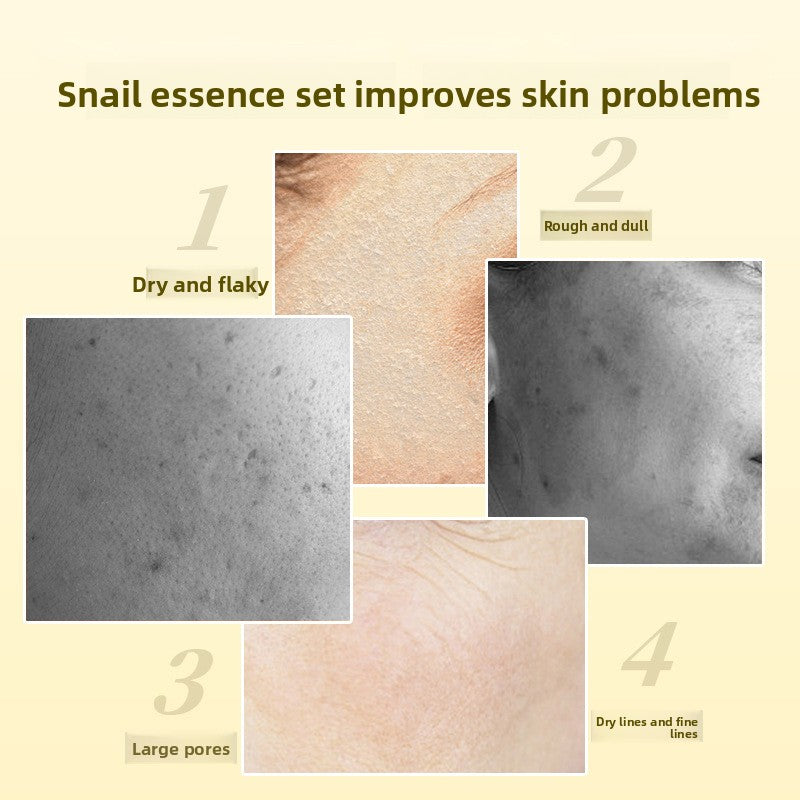 Snail Essence Skincare