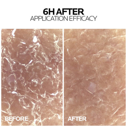 La Roche Posay Lipikar Baume APM+ Moisturizer for Very Dry and Skin Prone to Atopy