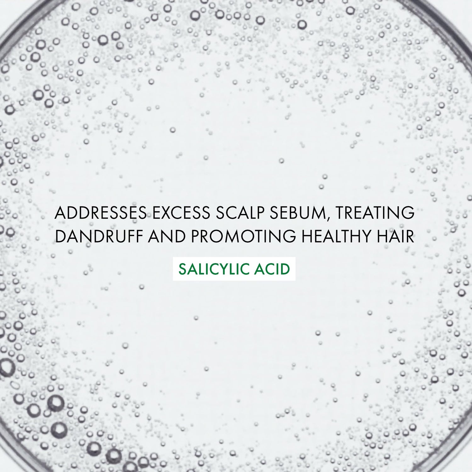 Vichy Dercos Anti-Dandruff Shampoo for Sensitive Scalps - Gentle, Effective Treatment - 200ml