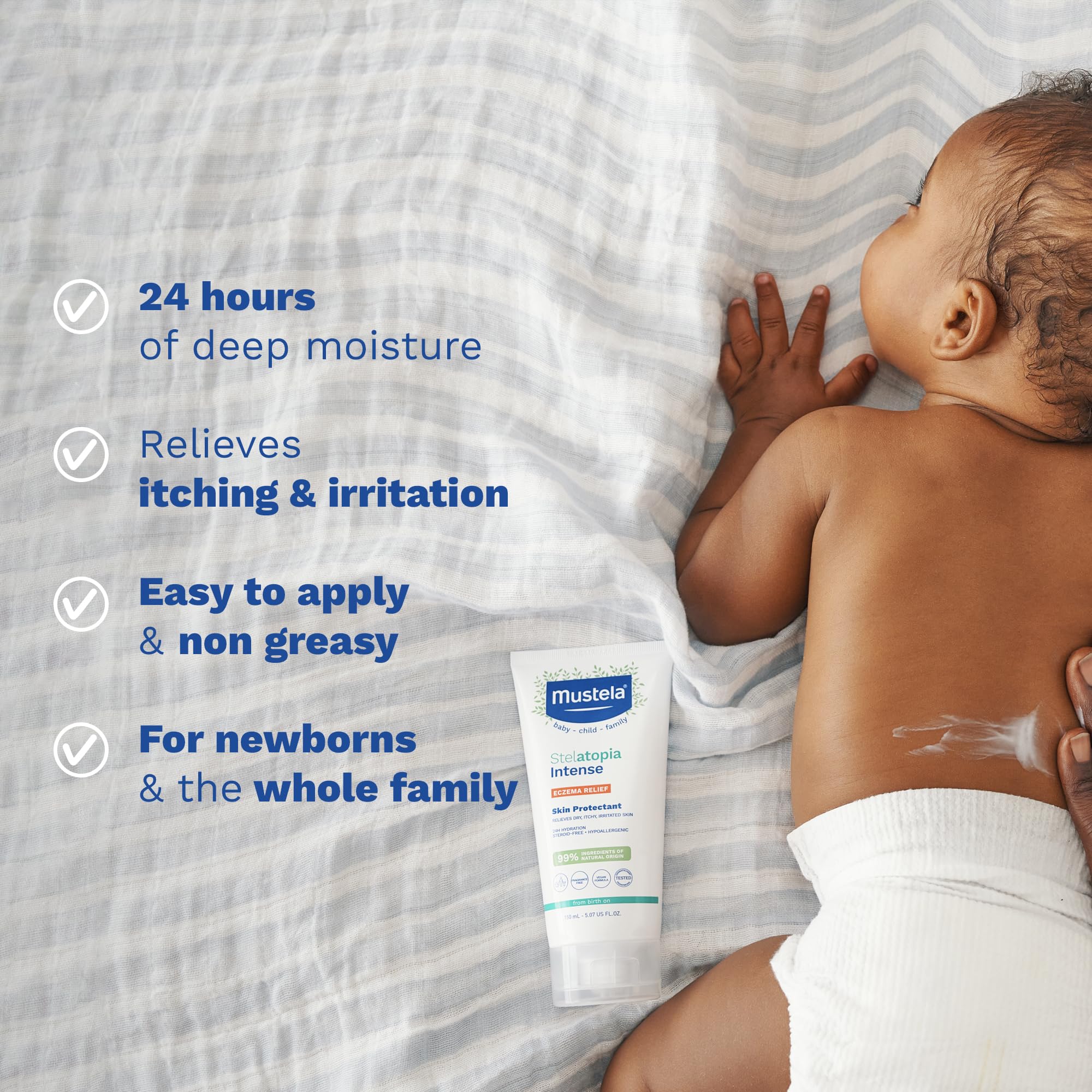 Mustela Stelatopia Intense - Non-Corticosteroid Cream | 30 ml