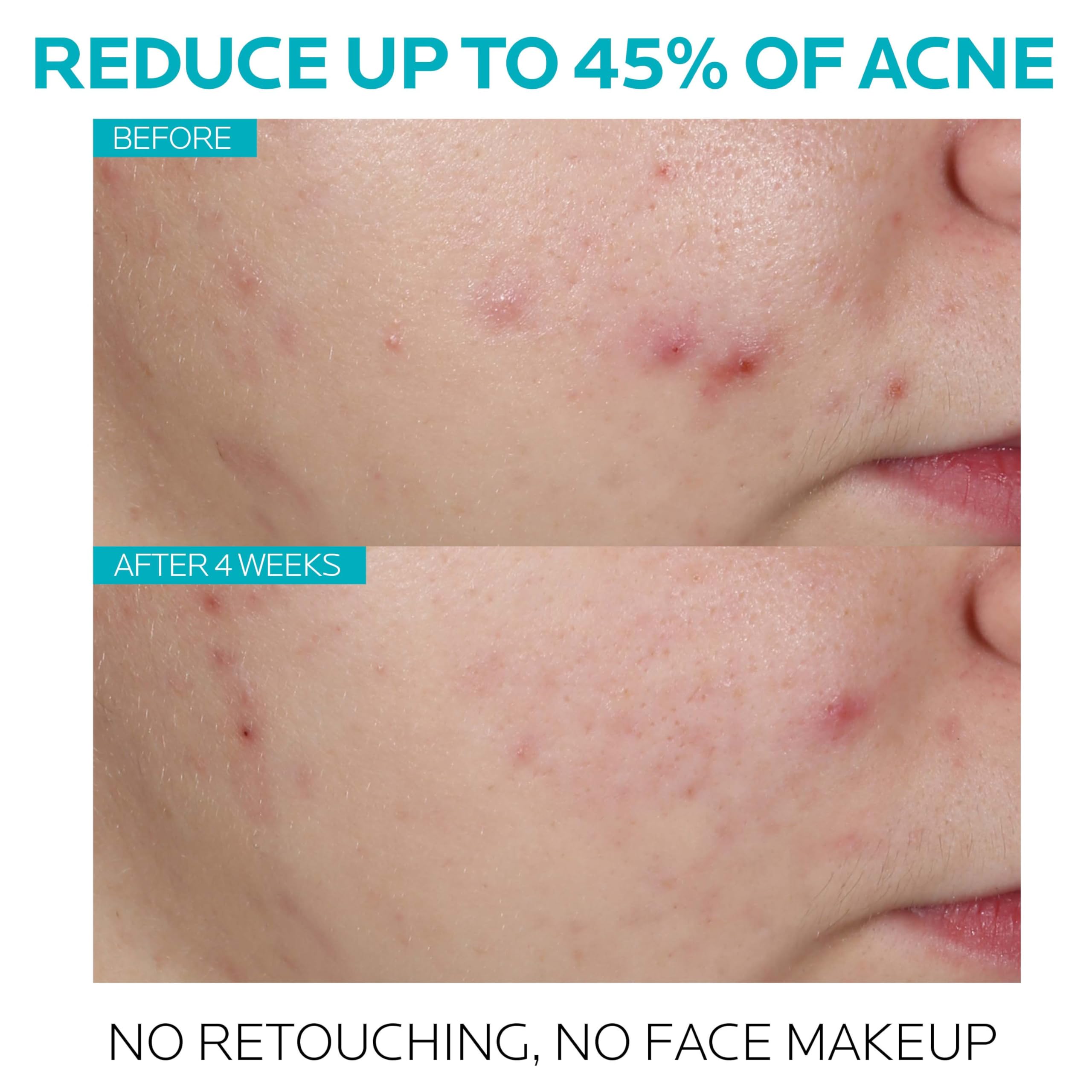 La Roche Posay Effaclar Ultra Concentrated Serum 30ml
