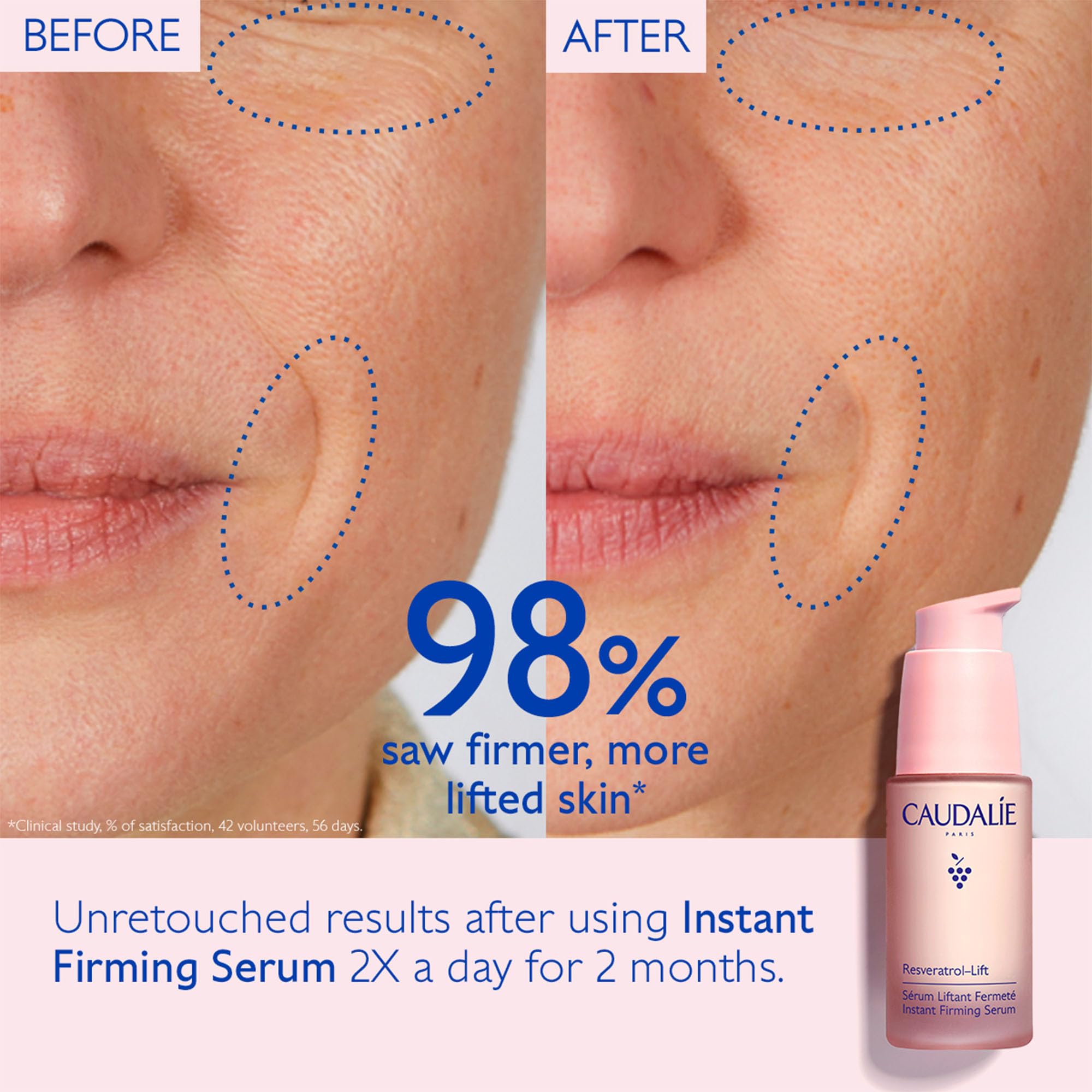 Caudalie Resveratrol Lift Firming Serum - Anti-Aging, Firming &amp; Lifting Serum with Resveratrol for Youthful Skin