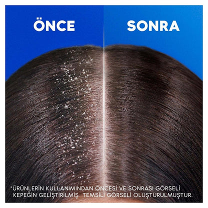 Head &amp; Shoulders Anti-Dandruff Shampoo with Coconut Oil - Moisturizing, Dermatologically Tested - 11.16 fl oz