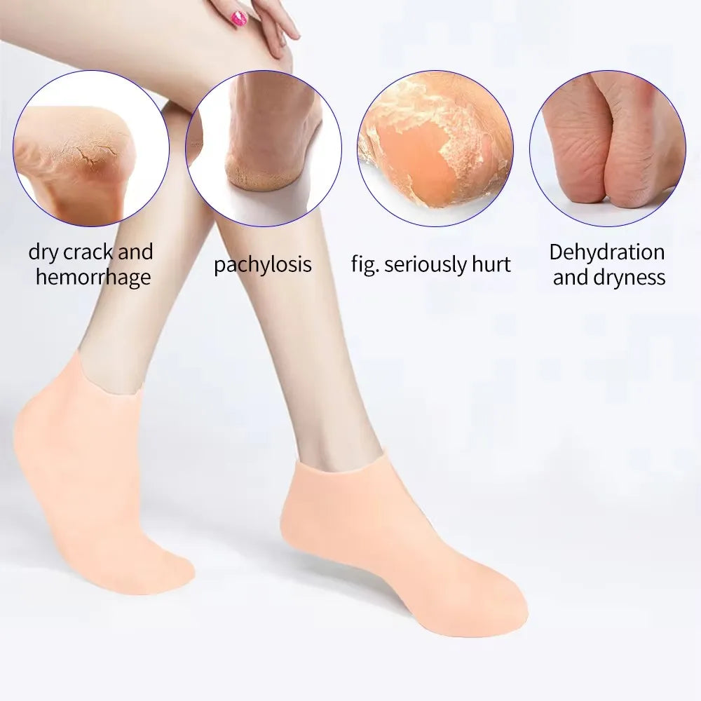 Silicone Exfoliating Socks &amp; Gloves Anti Slip Foot &amp; Hand Spa Mask Hands Peeling Gloves Prevents Dryness Feet/Hand Care Tools
