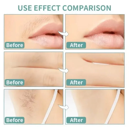 20stick Professional Hair Removal Wax Strips for Summer Depilation Double Sided Cold Wax Paper for Leg Body Face Useful