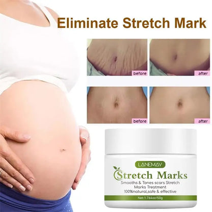 Stretch Marks Permanent Removal Cream Maternity Pregnant Women Pregnancy Anti-Winkle Smooth Repair Firming Skin Body Skin Care