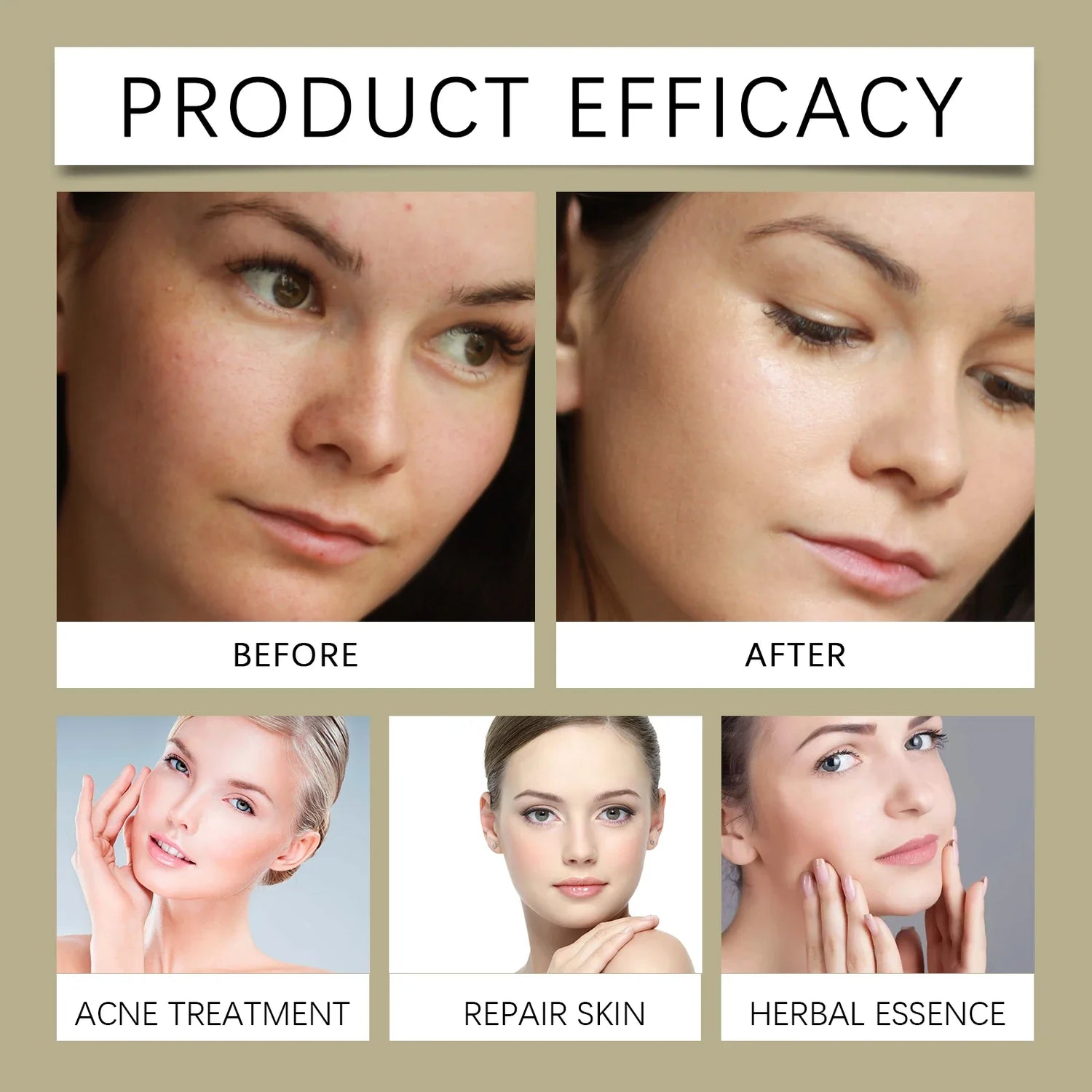 Glycolic Acid 7% Moisturizing Toner Remove Acne Improve Skin Condition Replenish Water Moisturize Skin Tender Skin&amp;Toner Essence