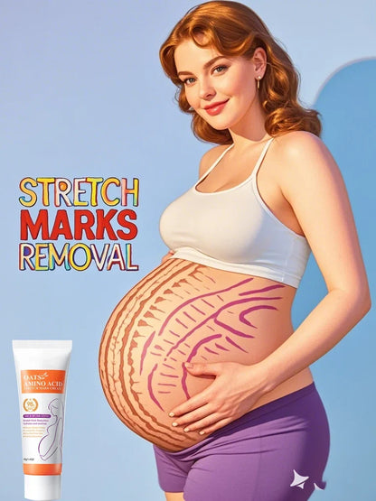 Cream For Pregnancy Stretch Marks Removal Eliminate Red White Old Stretch Marks 26