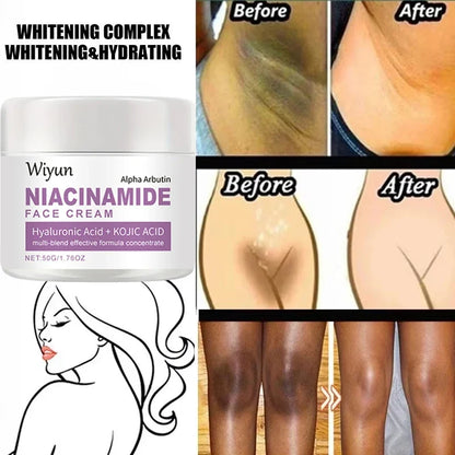 Body Whitening Cream Private Parts Underarm Bleaching Serum Whiten Butt Knee Brighten Inner Thigh Intimate Dark Remove Melanin