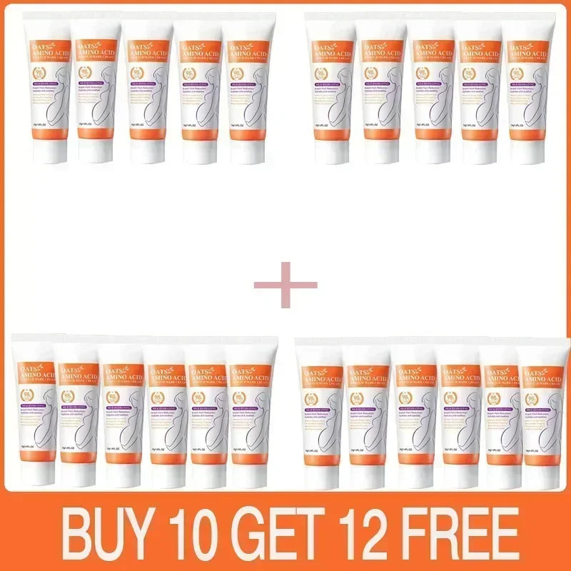 Cream For Pregnancy Stretch Marks Removal Eliminate Red White Old Stretch Marks 26