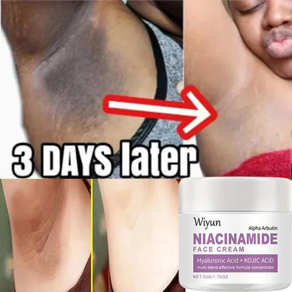Body Whitening Cream Private Parts Underarm Bleaching Serum Whiten Butt Knee Brighten Inner Thigh Intimate Dark Remove Melanin