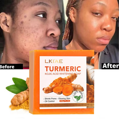 LKIAE Organic Turmeric Soap Bar, Natural Herbal Hand Made Whitening Soap, Remove Melanin, Acne, Spots, For Face And Body,200g