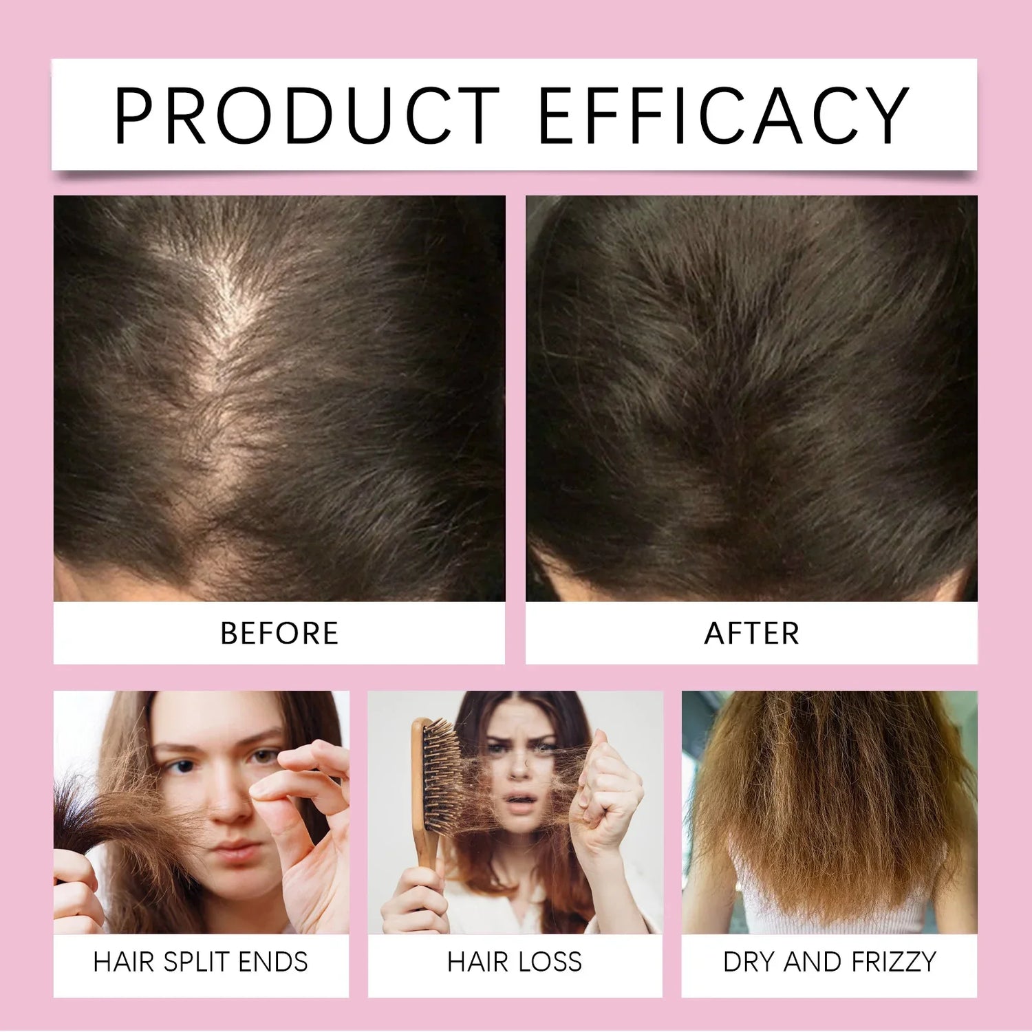 Rosemary Care Hair Essential Oil for Hair Growth Strengthens &amp; Prevents Hair Loss Repairs Dryness &amp; Split Ends Scalp Treatment