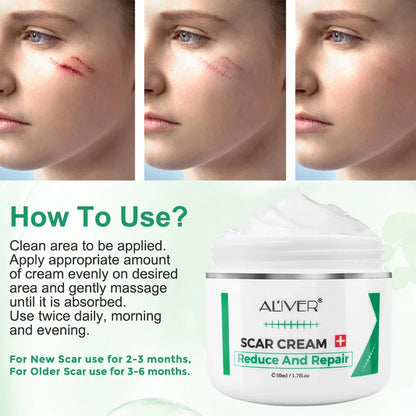 ALVER Acne Scar Stretch Marks Remover Cream Skin Repair Acne Black Dots Spots Acne Treatment Blackhead Bleaching Cream 50ml