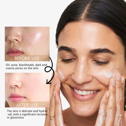 RAVE LADY Low PH 150ml Facial Cleanser Gentle Oil Control Moisturizing Face Wash Whitening Facial Foam Exfoliating Deep Remove