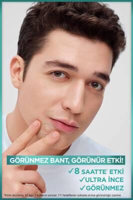 Garnier Pure Active: Anti-Acne Pore Strips with Salicylic Acid &amp; Tea Tree Oil - Blackhead Remover, Facial Cleanser (22 Strips)
